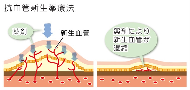 光干渉断層計（OCT/Optical Coherene Tomography）検査